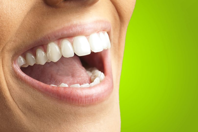 Factors To Consider When Choosing Between Dentures Or Full Mouth Implants ZOMG! Candy